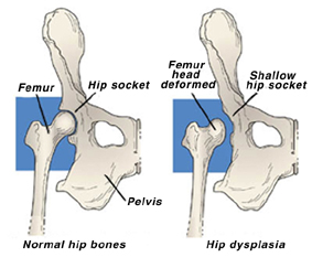 how do you know if your puppy has hip dysplasia